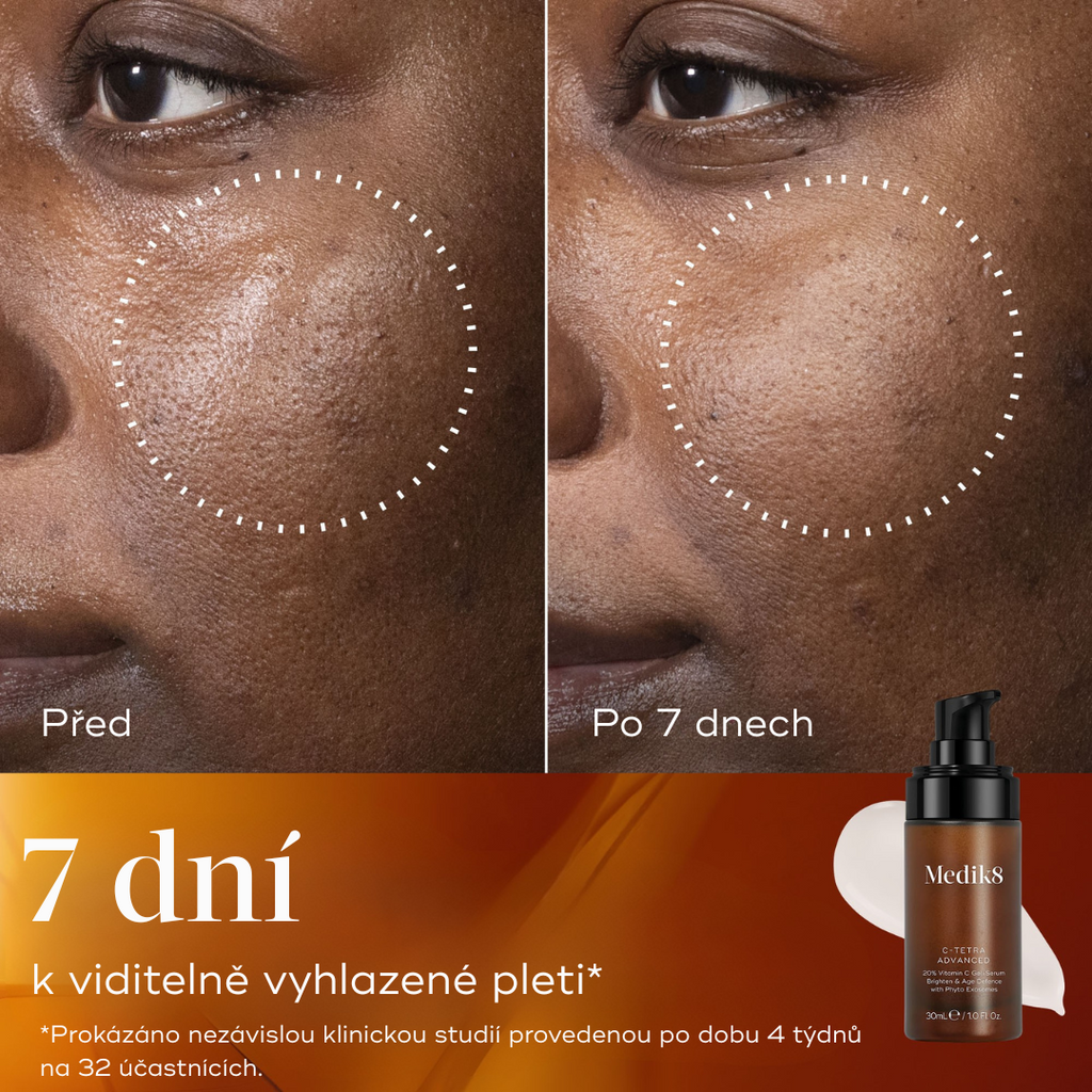 C-Tetra® Advanced