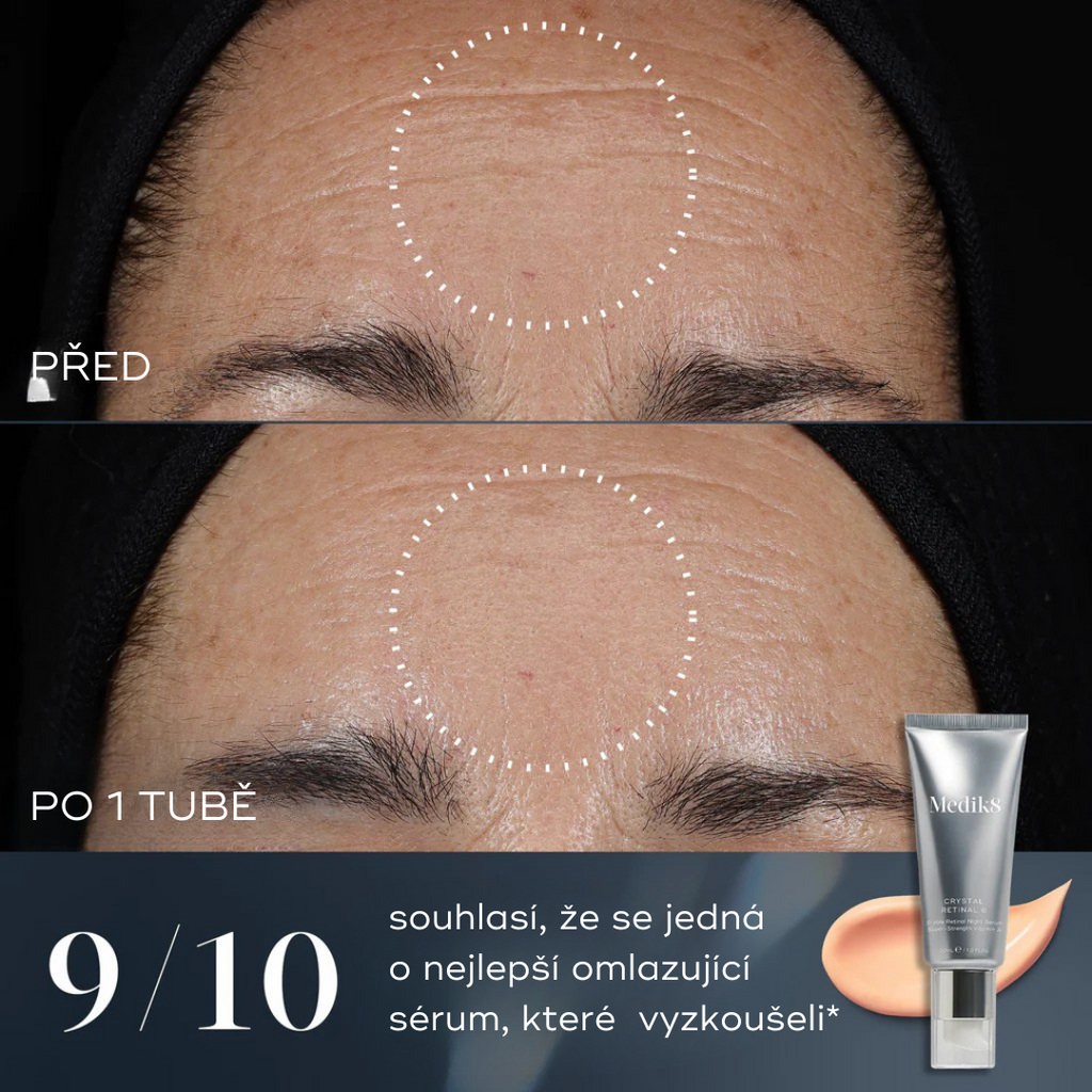 Crystal Retinal®