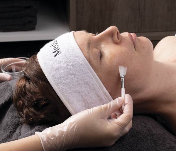 what is chemical peel